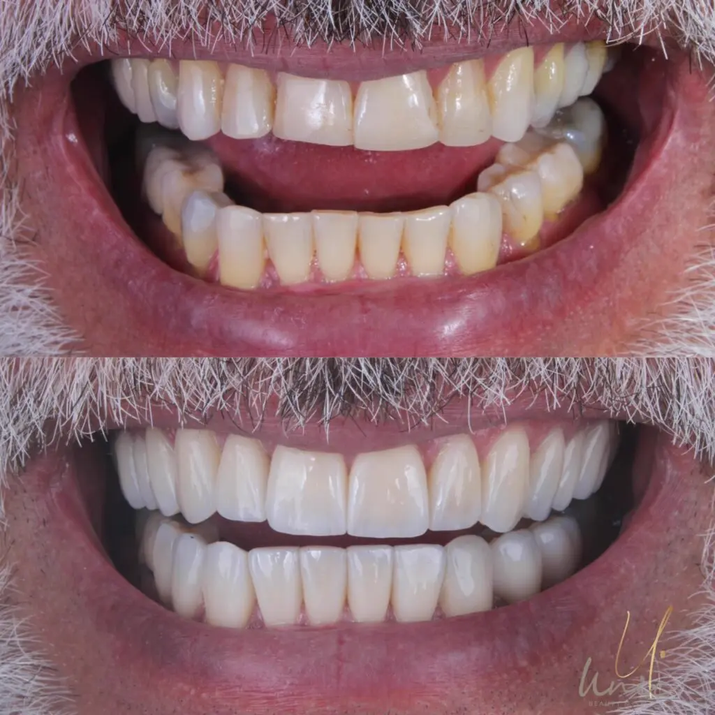 Transformação de Sorriso